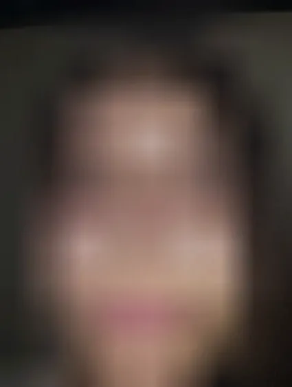 Lilly, 20